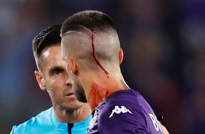 ECL -Biraghi ramt af kasteskyts: Gør noget ved de West Ham-fans