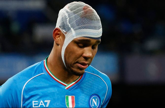 Serie A -Napoli må undvære skulderskadet brasser i en måned