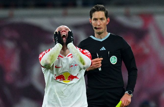 Bundesliga -Leipzig-midt misser EM med knæskade