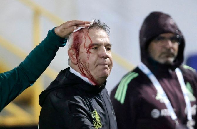 CONCACAF Nations League 1 -Øldåse slog mexicansk træner til blods: Sådan er fodbold 