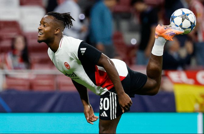 Bundesliga -Michy Batshuayi er blevet opereret 