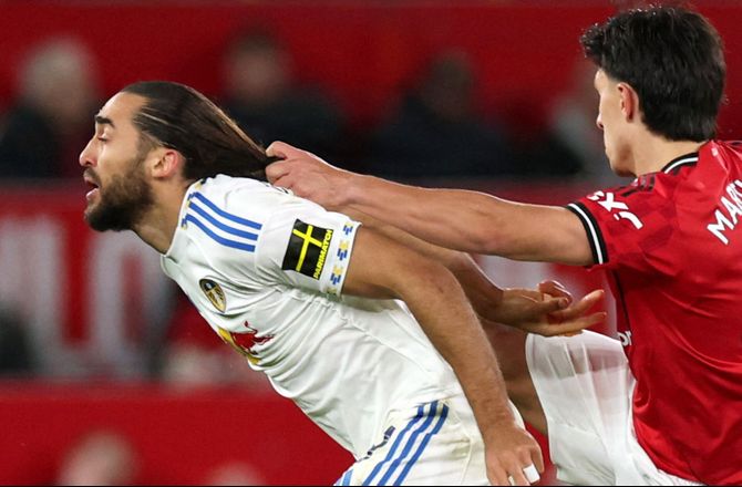 Premier League -Calvert-Lewin blev hevet i håret: Det er uheldigt for ham