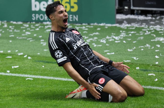 Bundesliga -Frankfurt-profil ramt af skade