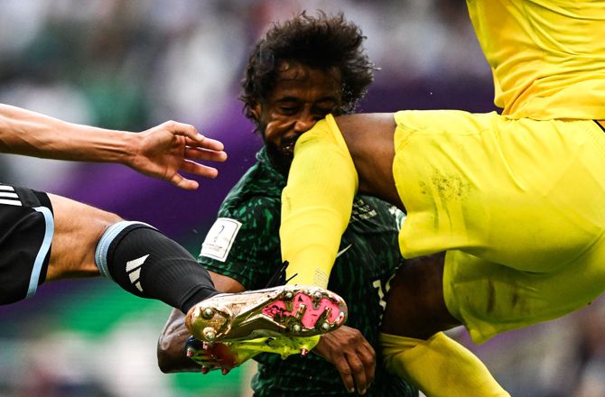VM -Fik knæ i hovedet: Saudiaraber skal opereres
